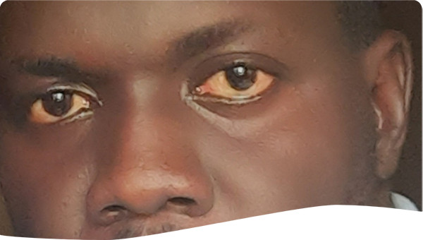 Picture of Wesonga Edward Rodney
