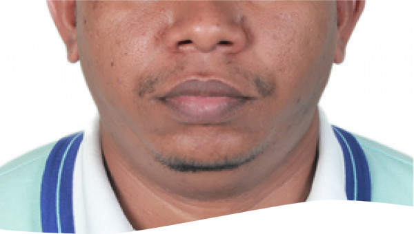 Dr Ahmed 